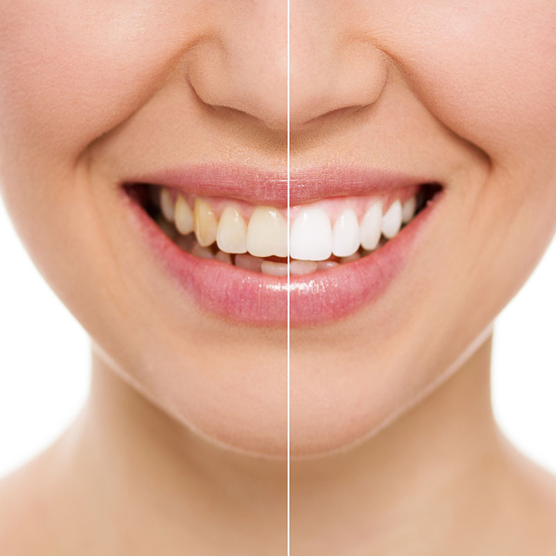 Best Dentist In Bangalore Best Dentist In Bangalore