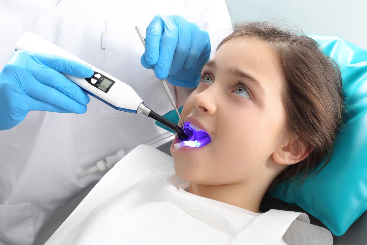 Laser Teeth Whitening Laser Teeth Whitening