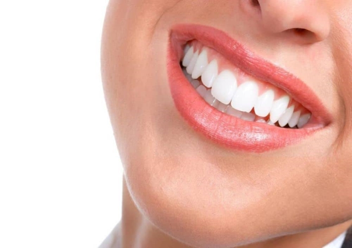 Best smile designing in Bangalore Best smile designing in Bangalore